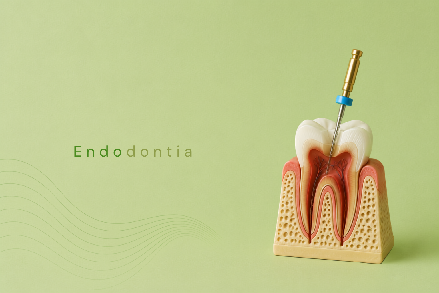 Endodontia

A Endodontia é a especialidade da Odontologia que mais se beneficiou com o avanço técnico e científico, sobretudo na última década, possibilitando oferecer tratamentos mais fáceis, rápidos, seguros e responsáveis.

A Endodontia tem como objetivo a preservação do dente por meio da prevenção, diagnóstico, prognóstico, tratamento e controle das alterações da polpa e dos tecidos perirradiculares.

As áreas de atuação da Endodontia incluem:

• Procedimentos conservadores da vitalidade pulpar;
• Procedimentos cirúrgicos no tecido e na cavidade pulpar;
• Procedimentos cirúrgicos paraendodônticos;
• Tratamento dos traumatismos dentários.

O avanço técnico-científico tem proporcionado maior segurança aos procedimentos odontológicos realizados nessa especialidade, promovendo importantes mudanças no cenário profissional e beneficiando diretamente os pacientes e os profissionais da área.

Tratamento de canal precisa ser doloroso e demorado?

A percepção de que o tratamento endodôntico é inevitavelmente doloroso e demorado vem sendo desconstruída. Atualmente, com o avanço das técnicas e dos recursos utilizados na Odontologia, o tratamento pode ser realizado com maior segurança e conforto para o paciente.

A Endodontia representa uma importante possibilidade de preservação do dente natural, respeitando suas condições e limitações.

Preservar os dentes sempre que possível é fundamental, pois a perda de um único elemento dentário pode comprometer a mastigação, a estética, a harmonia do sorriso e a saúde bucal como um todo.