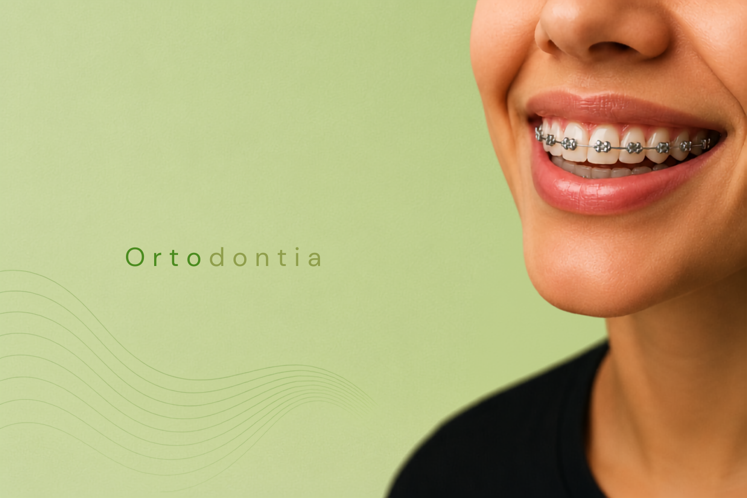 Ortodontia

Alinhadores Ortodônticos

Utilizamos jogos de alinhadores sequenciais, feitos sob medida. Os alinhadores são praticamente invisíveis e reposicionam os dentes gradualmente para alcançar o sorriso desejado.

É uma opção ortodôntica transparente, proporcionando estética, conforto e discrição durante o tratamento.

Principais características:

1 - Os alinhadores podem ser retirados para comer, escovar os dentes e passar fio dental.
2 - Não possuem fios ou metais que possam irritar a boca.
3 - A troca dos alinhadores é realizada de acordo com o planejamento definido pelo ortodontista.
4 - Os dentes se movimentam gradualmente durante o tratamento.
5 - Os alinhadores ortodônticos interferem pouco na rotina e no estilo de vida.
6 - Por serem discretos, muitas pessoas nem percebem que o paciente está em tratamento.

Aparelhos com Bráquetes Estéticos

Com o desenvolvimento dos bráquetes estéticos de safira, a Ortodontia ganhou uma alternativa para pacientes que buscam eficiência associada à discrição durante o tratamento.

Aparelho Convencional x Aparelho de Safira

Os bráquetes de safira são produzidos com material cerâmico monocristalino e possuem aspecto transparente, tornando o aparelho menos perceptível.

Sua característica estética se mantém durante o tratamento e, quando associados a arcos estéticos, proporcionam um conjunto mais discreto quando comparado ao aparelho metálico convencional.

Aparelhos Autoligáveis

Os aparelhos autoligáveis utilizam um sistema próprio para prender o fio ortodôntico aos bráquetes, dispensando o uso das tradicionais borrachinhas.

Esse sistema trabalha com o conceito de menor atrito e forças controladas, podendo proporcionar maior eficiência em determinadas etapas do tratamento.

A indicação do tipo de aparelho mais adequado deve ser realizada pelo ortodontista após avaliação individualizada das necessidades de cada paciente.