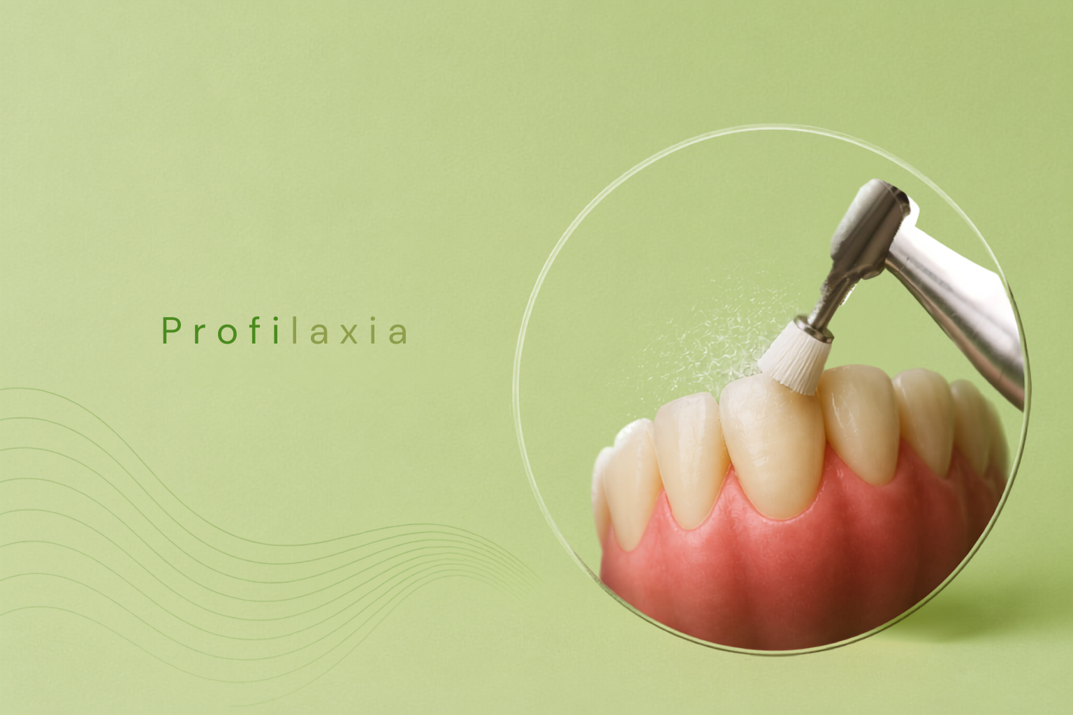 Profilaxia Dental

A profilaxia, também conhecida como limpeza dental profissional, é um procedimento importante para a manutenção da saúde bucal e para complementar os cuidados realizados diariamente em casa.

O procedimento auxilia na remoção de placa bacteriana, tártaro e algumas manchas superficiais que podem se acumular nos dentes ao longo do tempo, proporcionando uma sensação de limpeza e contribuindo para a aparência do sorriso.

Por que realizar a profilaxia?

A remoção profissional da placa bacteriana e do tártaro ajuda na prevenção de problemas bucais, como cáries, gengivite e outras alterações relacionadas ao acúmulo de biofilme.

Além disso, a limpeza profissional permite que o cirurgião-dentista acompanhe periodicamente as condições dos dentes e da gengiva, identificando possíveis alterações que necessitem de atenção.

Profilaxia e prevenção

A saúde bucal está relacionada à saúde geral do organismo. Por isso, manter uma boa higiene bucal, realizar acompanhamento odontológico e controlar adequadamente a placa bacteriana são cuidados importantes para a manutenção da saúde.

Com que frequência devo realizar a limpeza dental?

A frequência ideal varia de acordo com as necessidades de cada paciente. O cirurgião-dentista poderá determinar o intervalo mais adequado após avaliar fatores como saúde gengival, presença de tártaro, higiene bucal e histórico odontológico.

A profilaxia profissional, associada à escovação adequada e ao uso diário do fio dental, contribui para manter dentes e gengivas saudáveis.